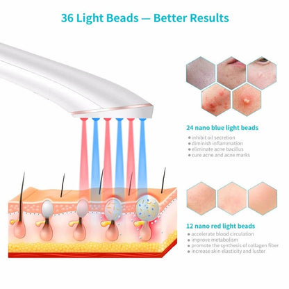 Acne Light Therapy Xpreen Wireless Rechargeable Light Acne Treatment Device Acne Clearing Eraser with Blue Light and Red Light - Holy Mango Store