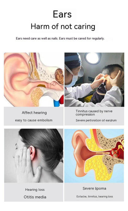 Wireless Smart HD Endoscope Luminous Ear Pick Ear Picking Tools - Holy Mango Store